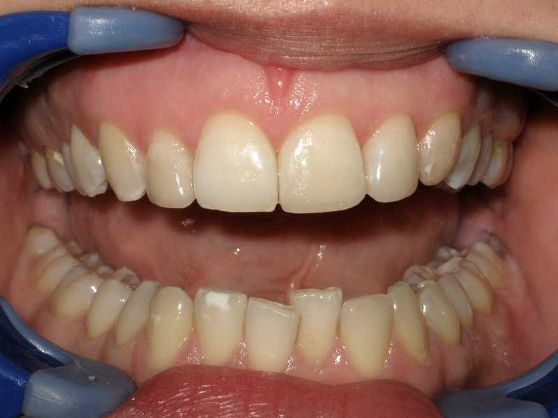 What is the Difference Between a Dentist and An Orthodontist?