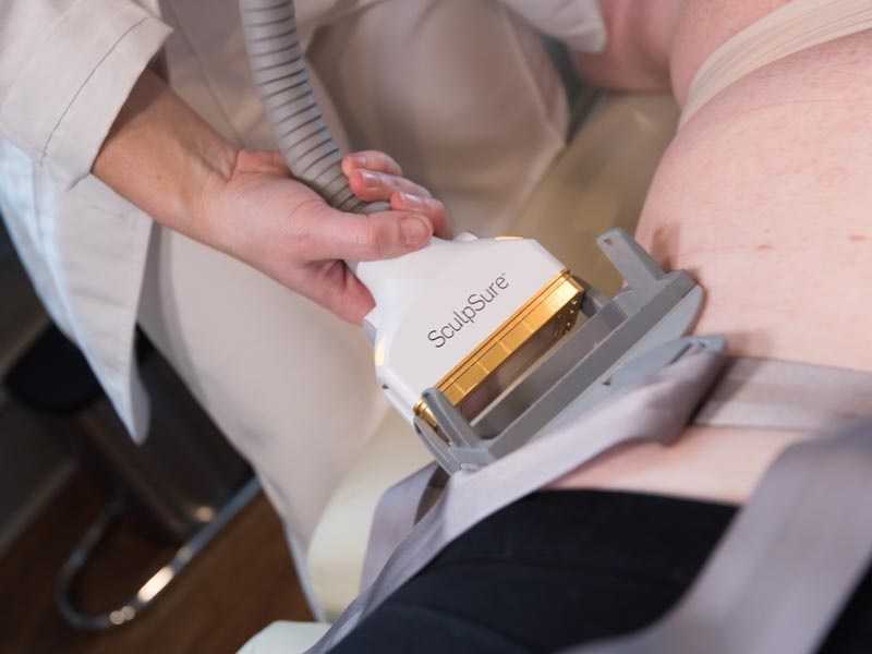 SculpSure Laser Fat Removal vs. CoolSculpting: Which is Better?