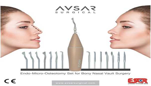 Things to Know About Micro-Rhinoplasty and the Rhinosculpture Tools