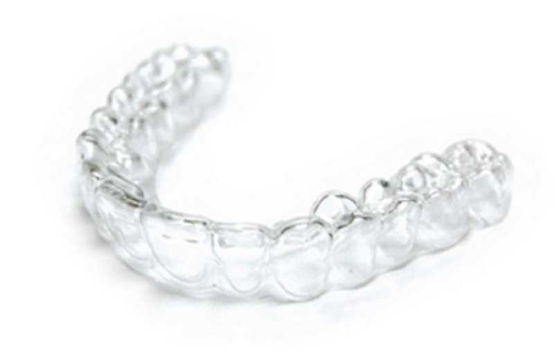 A Complete Guide on How Invisible Braces Works