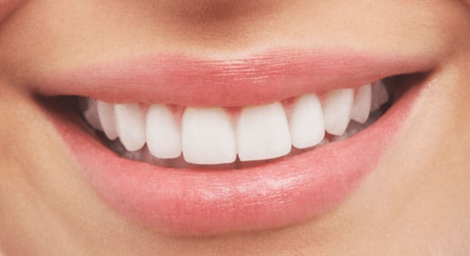 Show Off an Attractive Smile with Dental Veneers