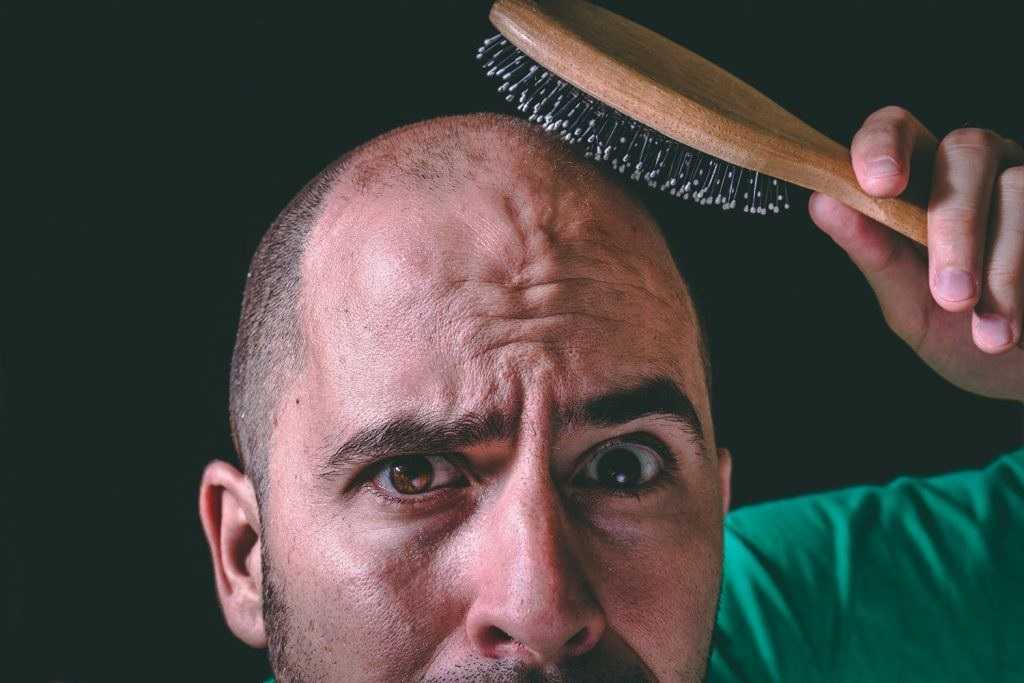 Does Baldness Really Run in the Family?