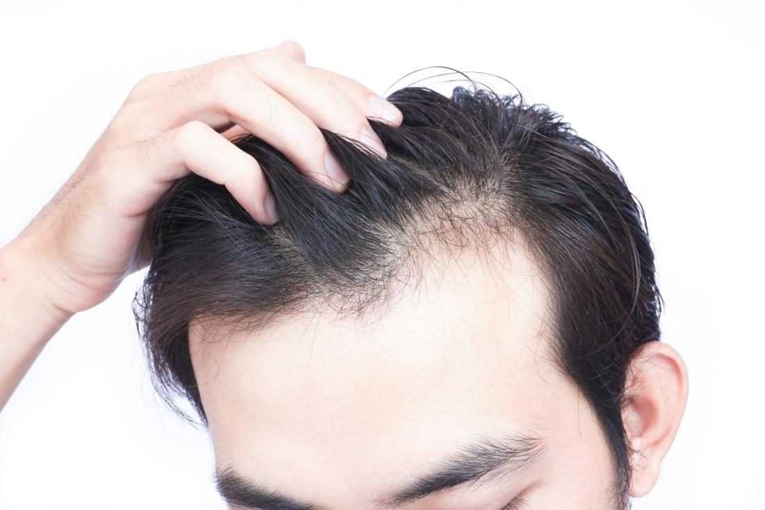 Hair Restoration 101: Choosing the Right Procedure for You