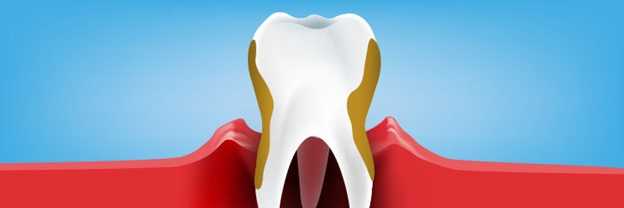 Check Periodontist In Phoenix and Learn About The Most Successful Treatments For Periodontal Disease