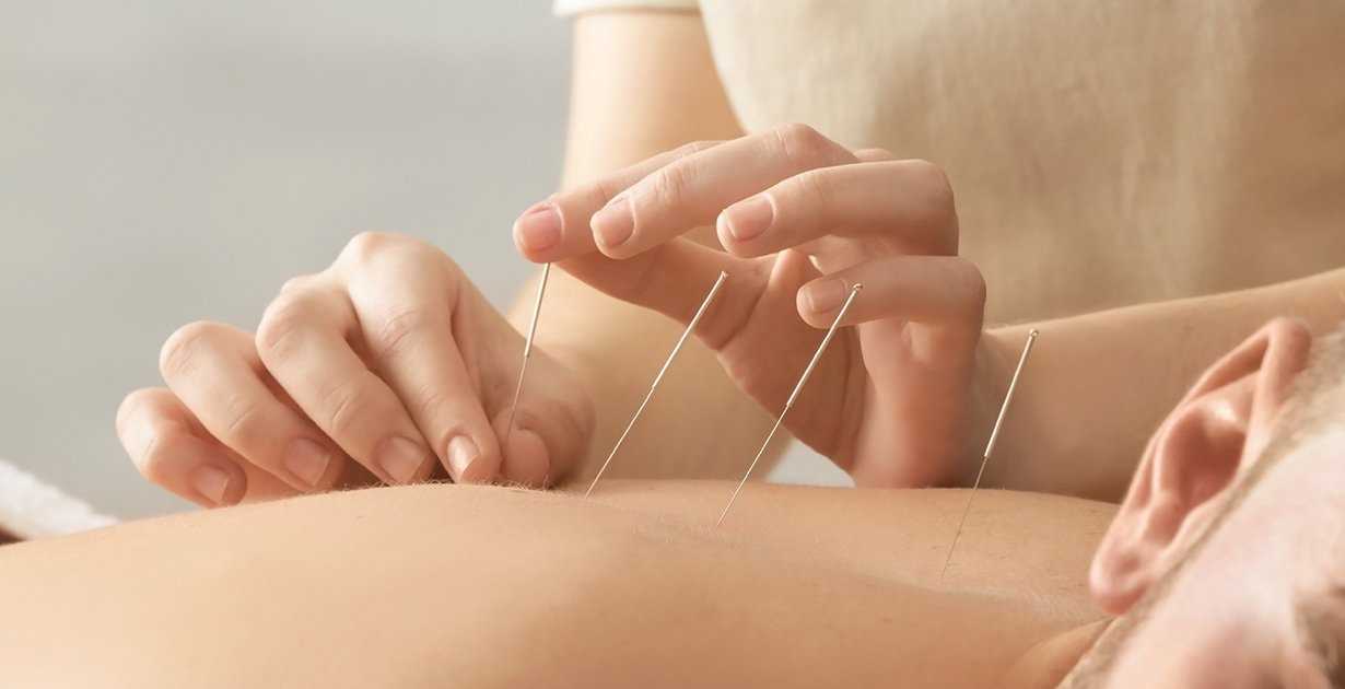 The advantages of following acupuncture for body care