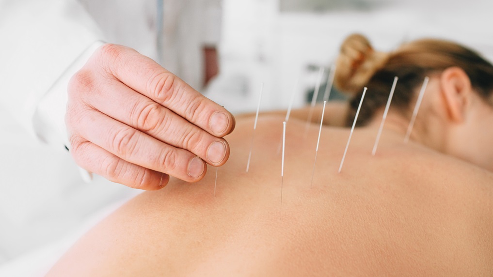 Avoid Doing After Acupuncture