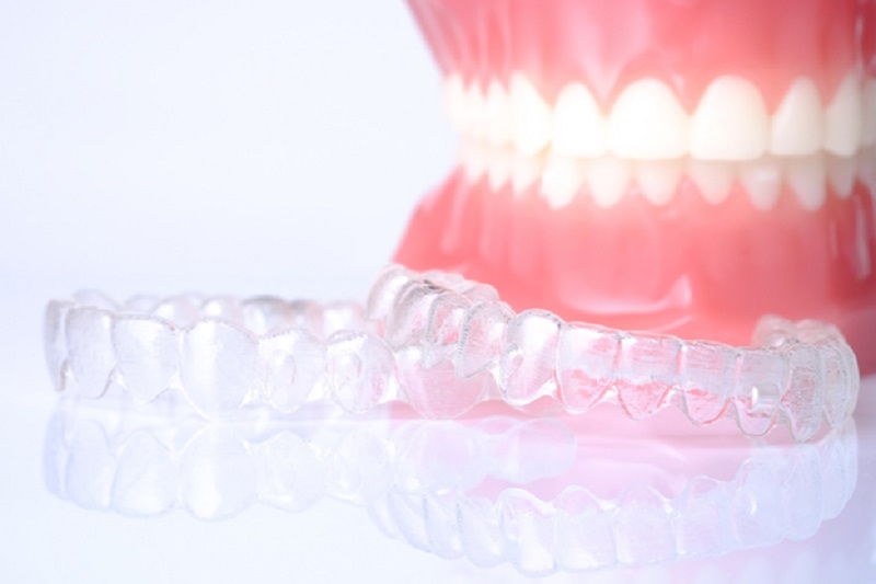 Unmasking invisible braces: 10 strategies to maintain your smile