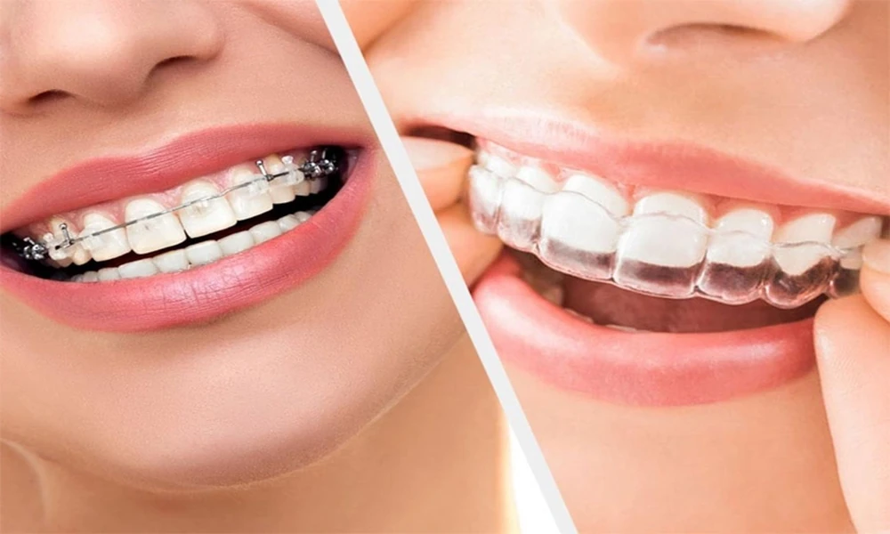 How Dentists Help Patients Choose The Right Toothbrush And Toothpaste
